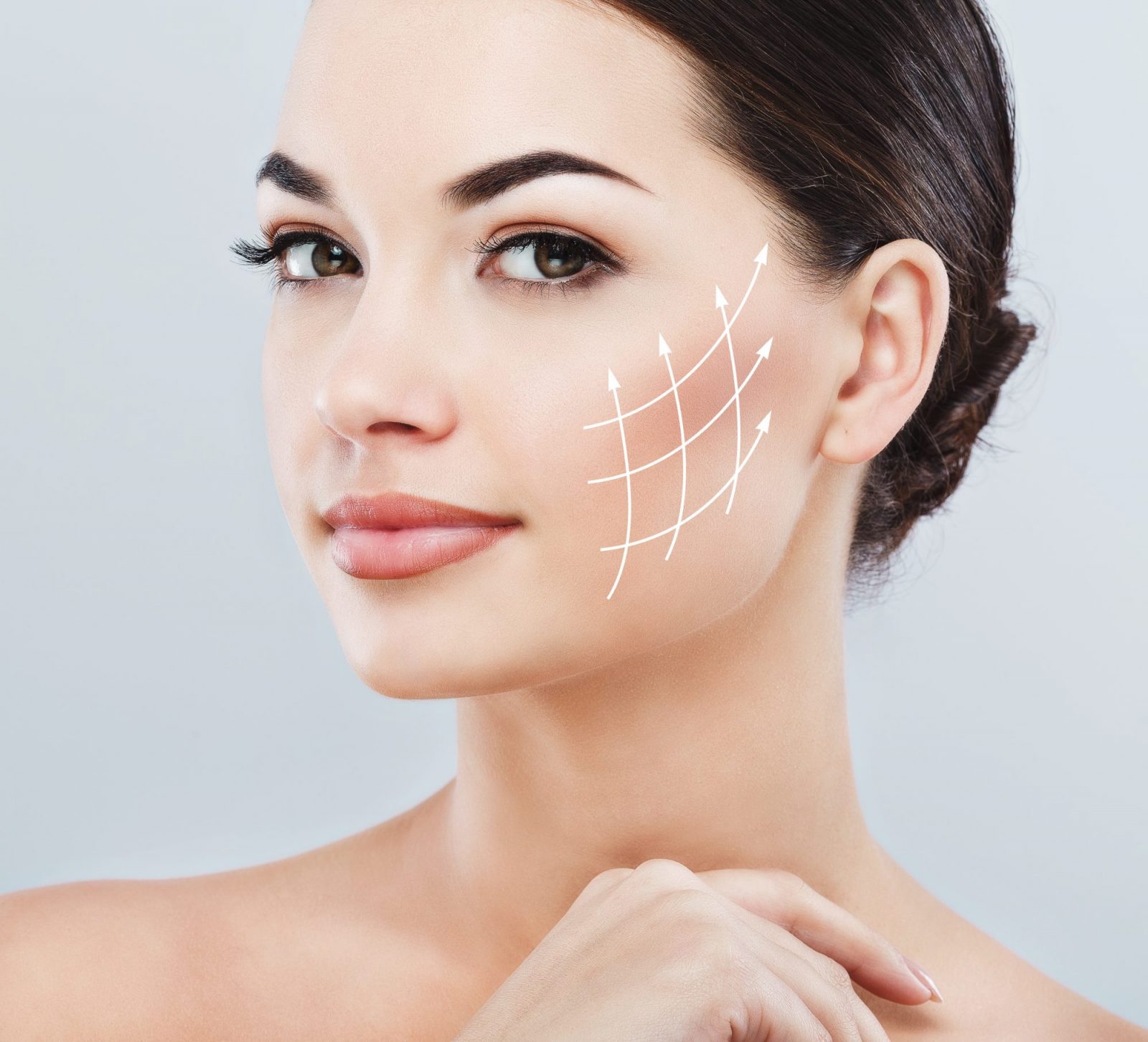 Thread Lift Sydney - Thread Face Lift - Fox Eye - Cheek - Neck Jowl Lift